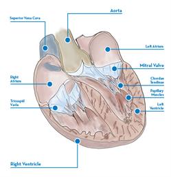 275_hvi_heart_surgery_booklet-heart-illustration-labeled_original