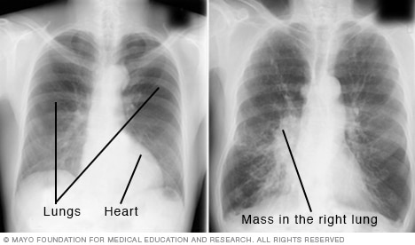 Medical image of chest X-rays
