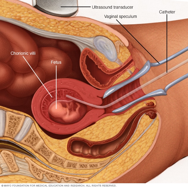 St Elizabeth Healthcare Procedure